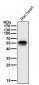Anti-Aromatase CYP19A1 Rabbit Monoclonal Antibody